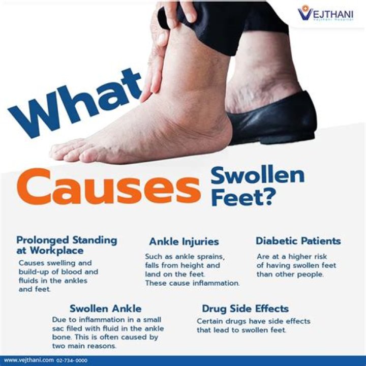 Are swollen ankles anything to worry about?