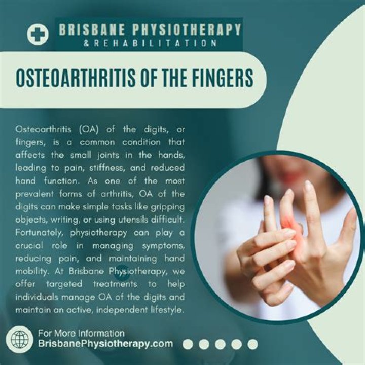 Can a rheumatologist help with osteoarthritis?
