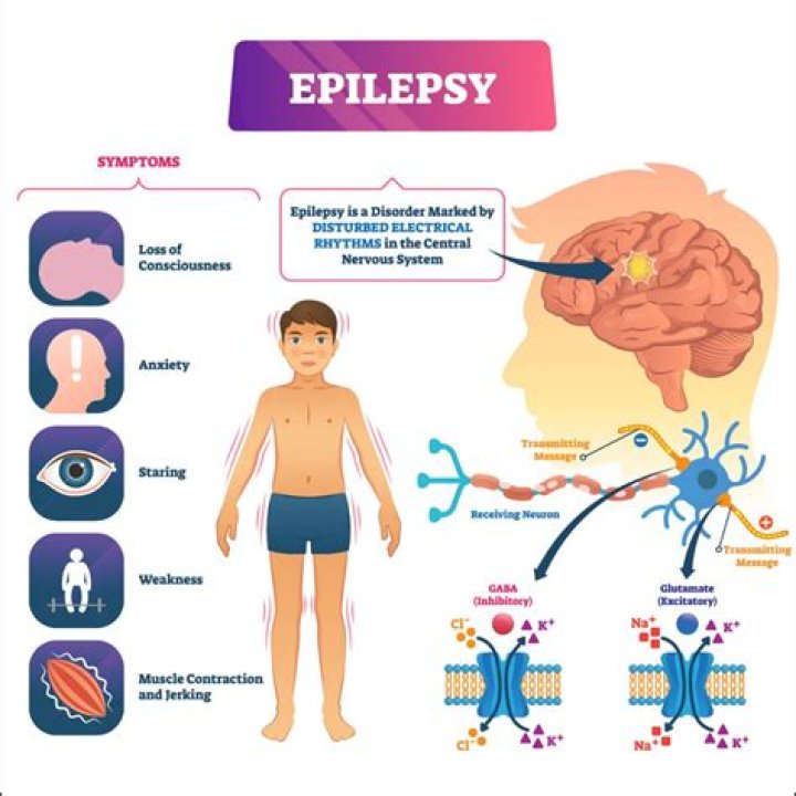 Can epilepsy turn into MS?
