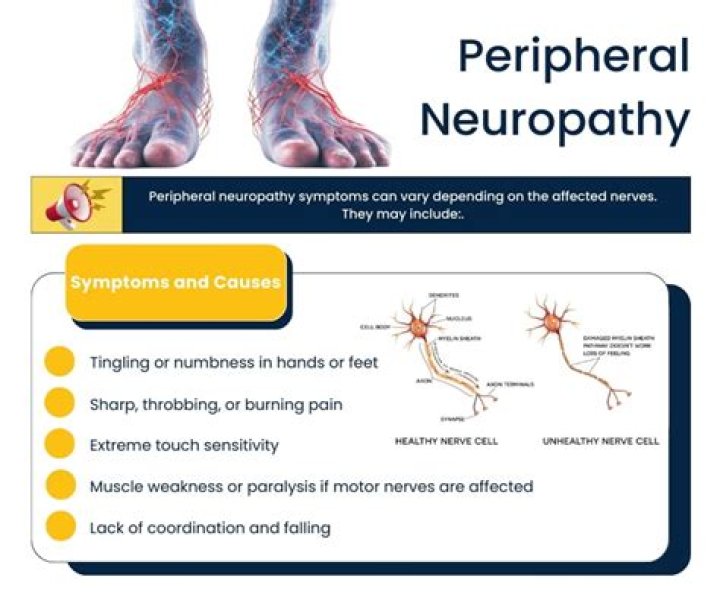 Can you have fibromyalgia and peripheral neuropathy?