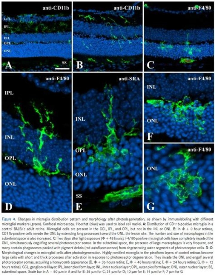 Does paraformaldehyde have autofluorescence?