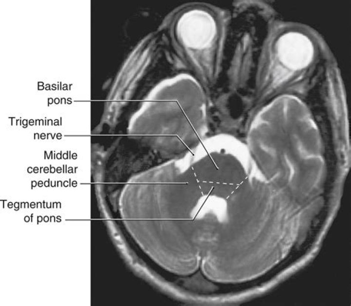 Does the pons connect to the cerebellum?