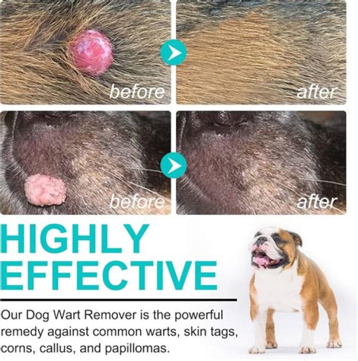 How do you get rid of pedunculated skin tags?