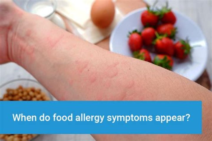 How do you know if you are allergic to spicy food?
