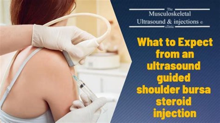 How long does a bursa injection last?