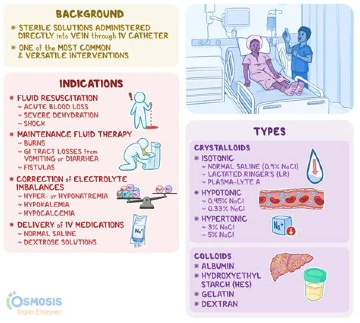 What are the indications of stress echocardiography?