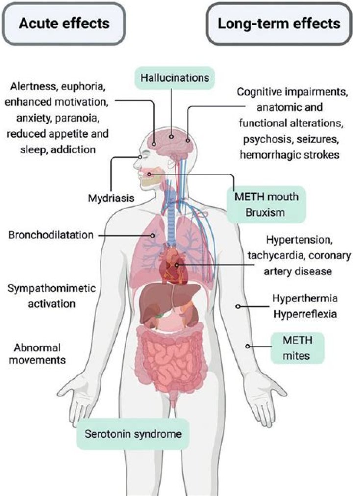 What are the long term effects of being in an induced coma?