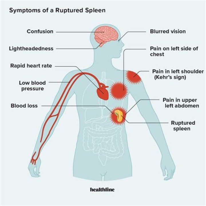 What are the symptoms of ticks in horses?