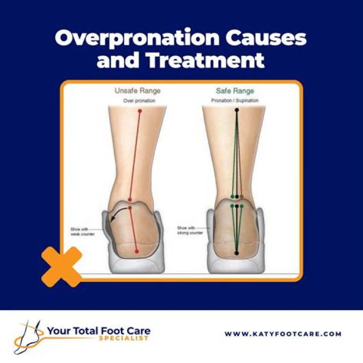 What causes foot contracture?