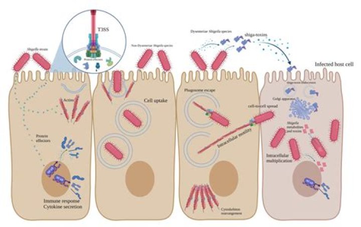 What disease does Shigella Sonnei cause?