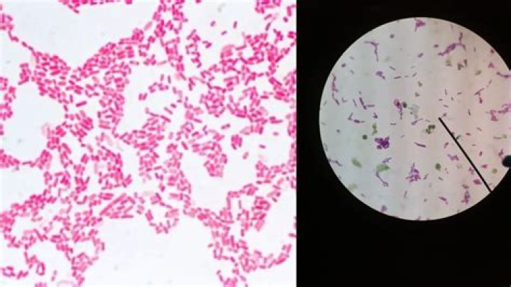 What does a Ponceau stain show?