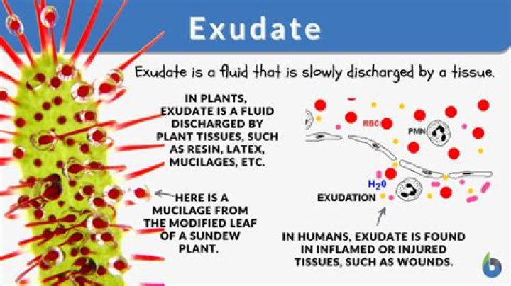 What does excessive exudate mean?