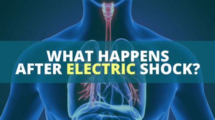What happens if you shock an electric eel?
