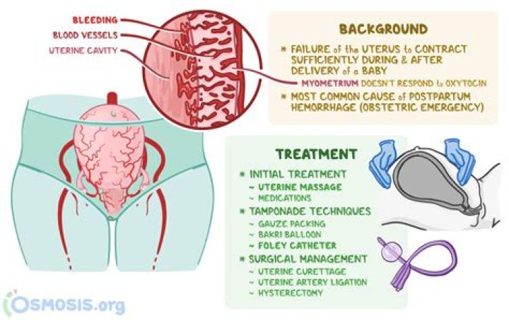 What is a distended uterus?