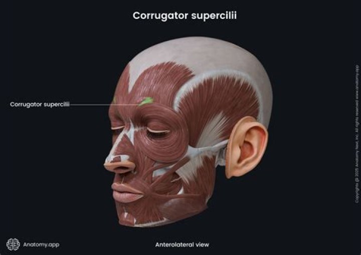 What is corrugator resection?