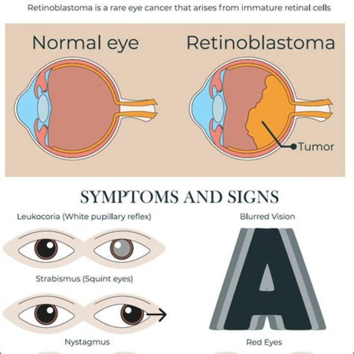 What is hereditary retinoblastoma?