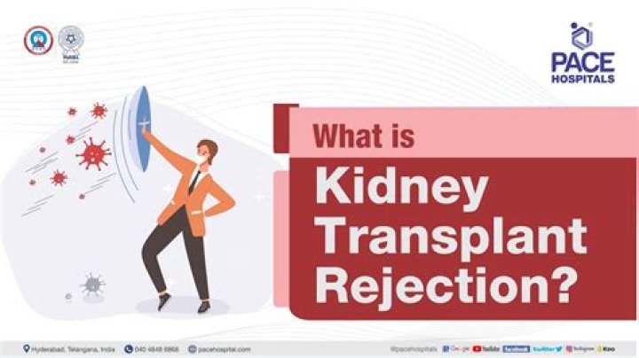What is kidney transplant rejection?