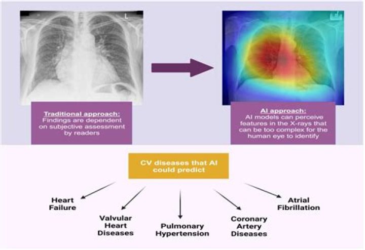 What is the best way to detect heart disease?