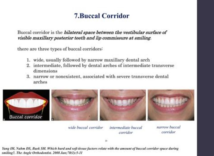 What is the buccal corridor?