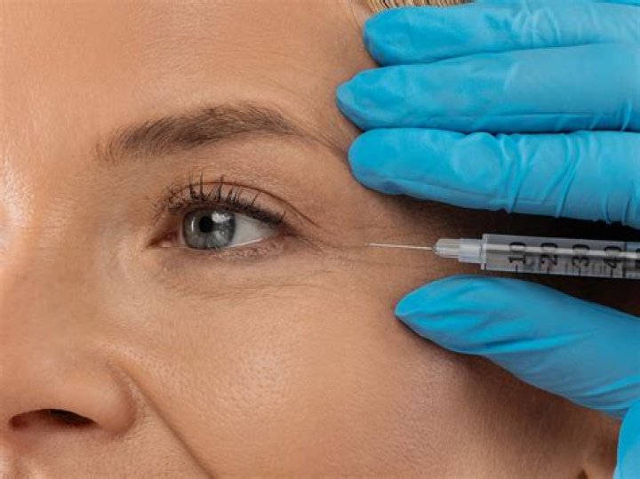What is the use of Itolizumab injection?