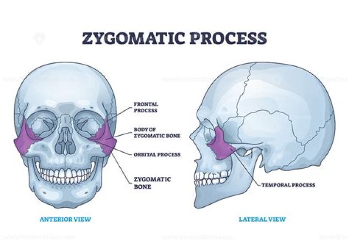 What processes form the zygomatic arch?