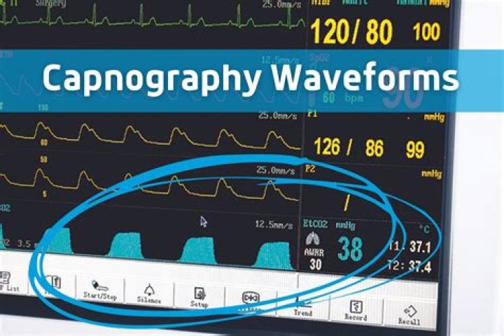 Which waveform indicates a decrease in compliance?