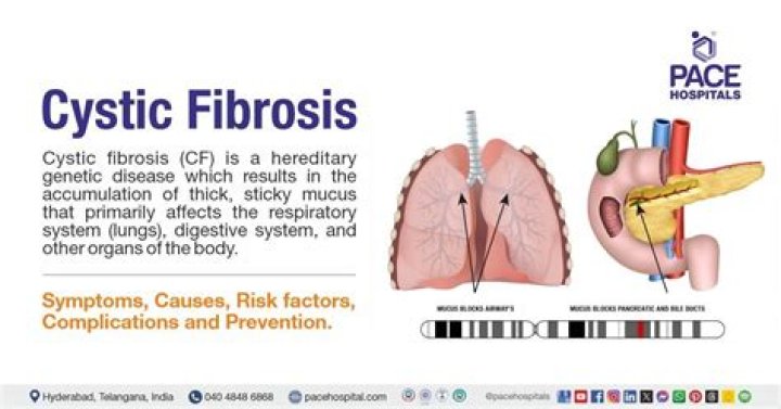 Why do cystic fibrosis patients have to be 5 feet apart?